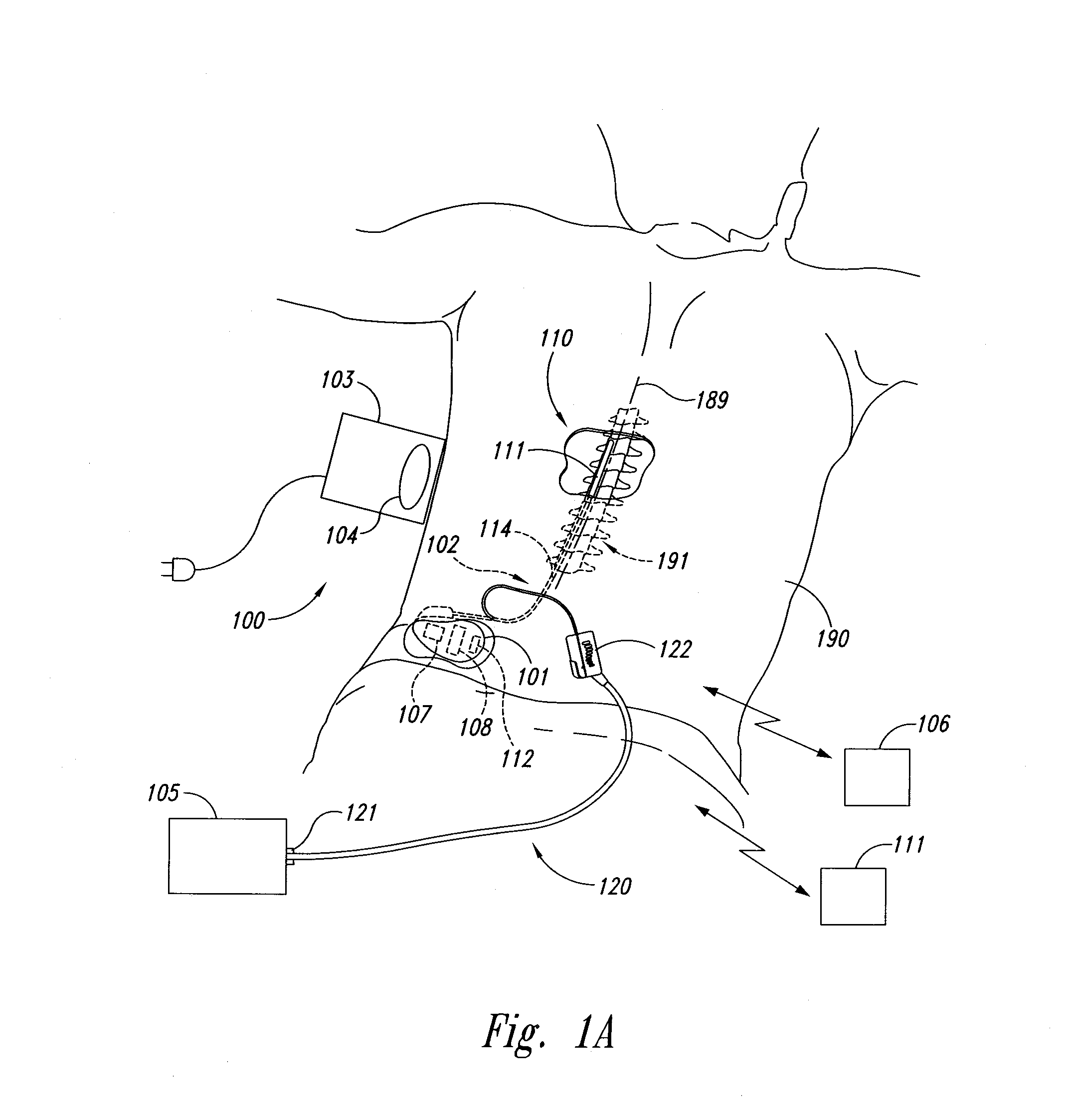 Selective high frequency spinal cord modulation for inhibiting pain with reduced side effects, and associated systems and methods