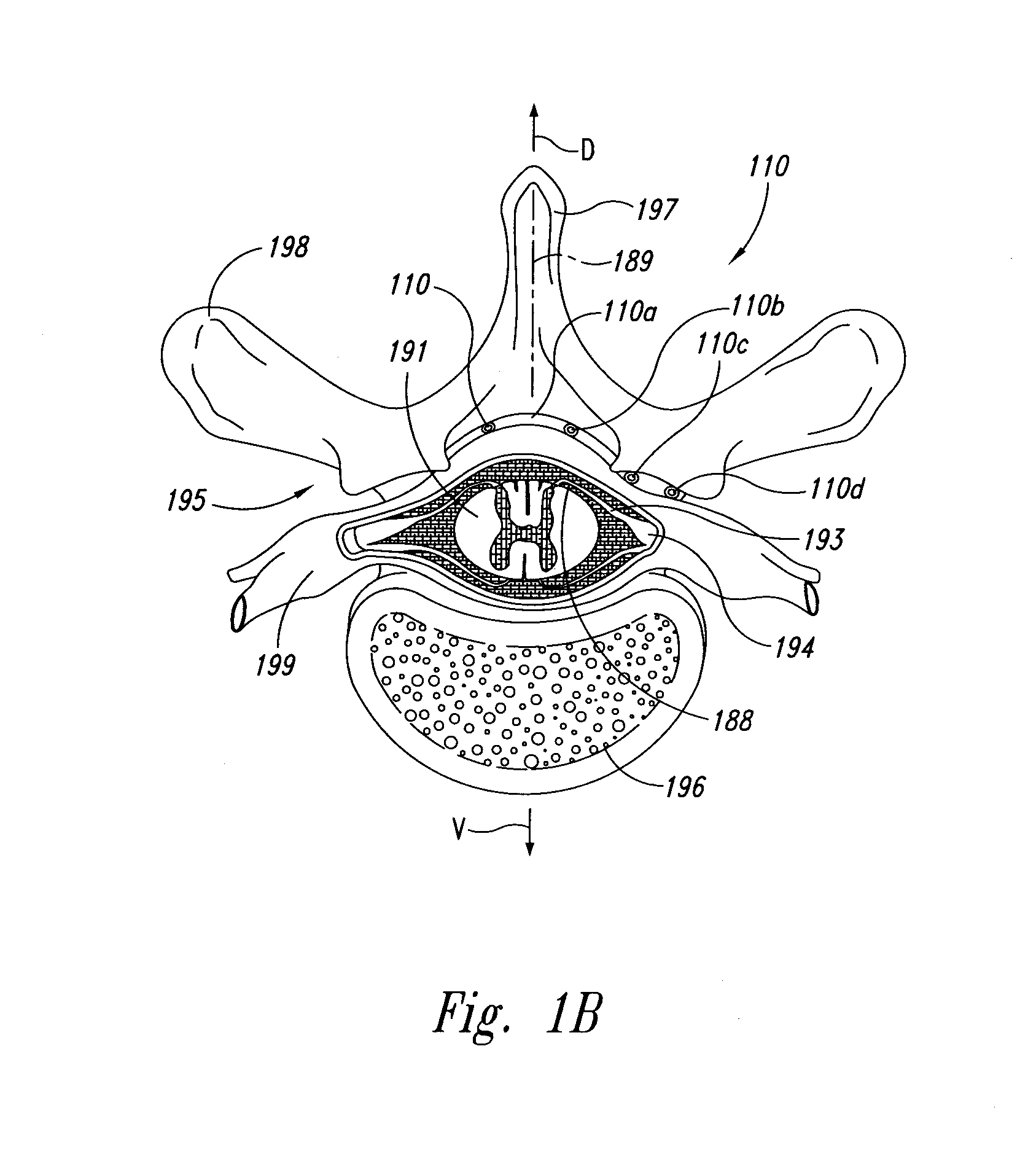 Selective high frequency spinal cord modulation for inhibiting pain with reduced side effects, and associated systems and methods