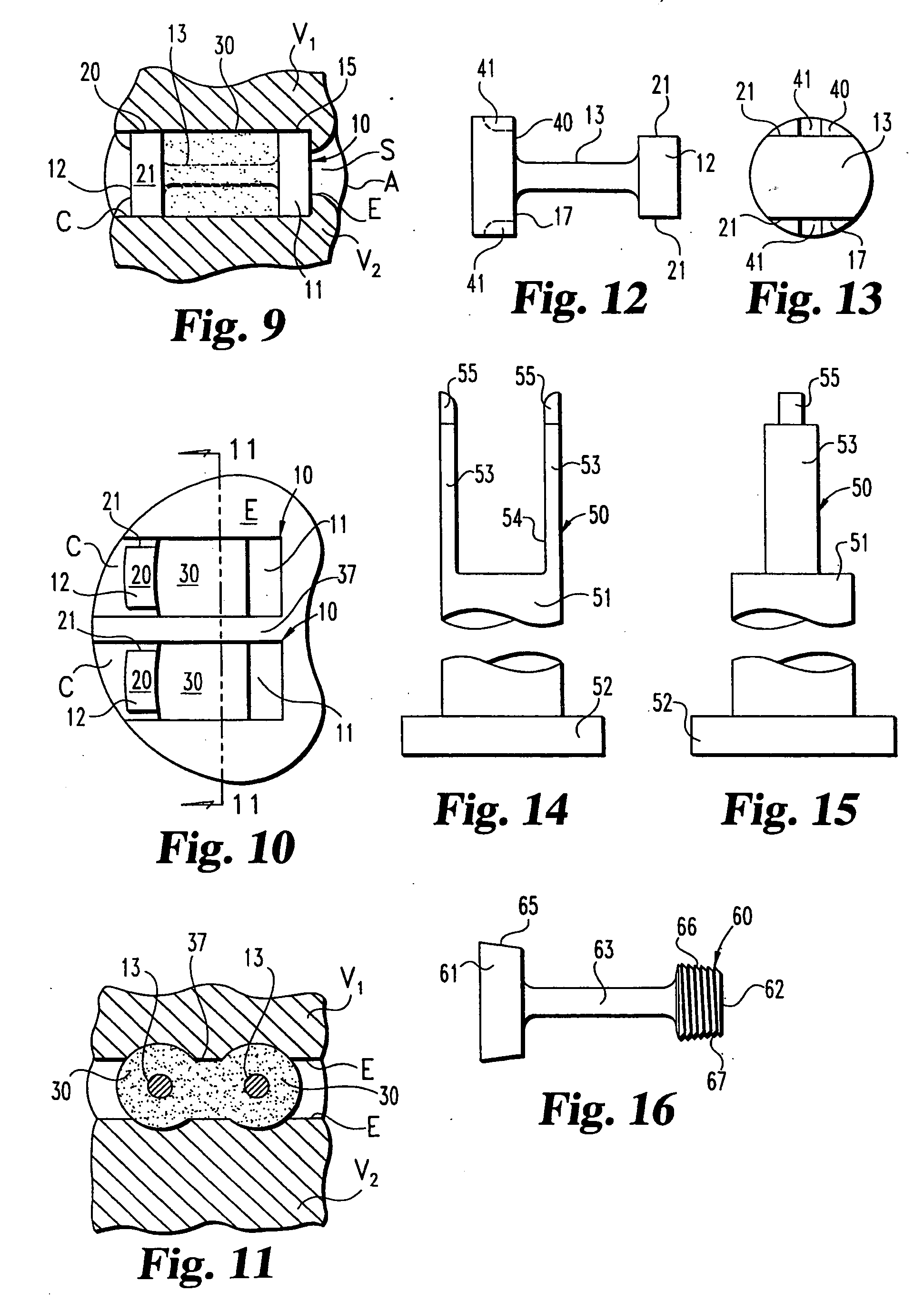 Osteogenic fusion device