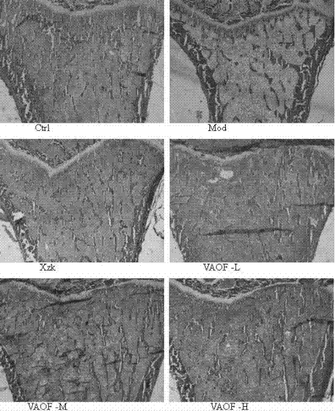 Application of a Compound Chinese Medicine in Prevention and Treatment of Osteoporosis