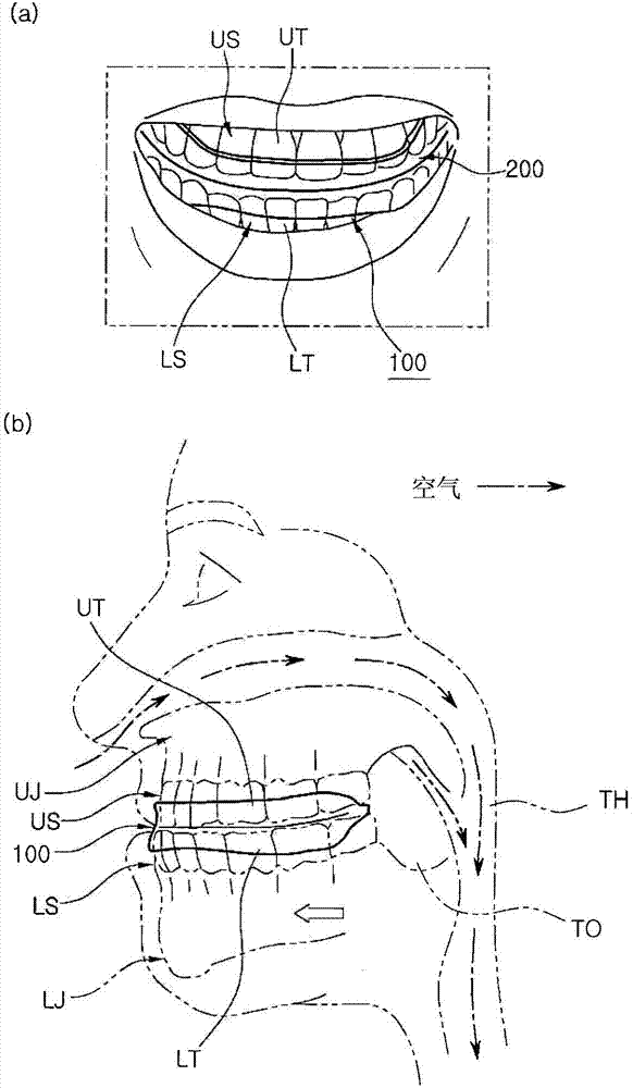 Mandible teeth fixing oral device