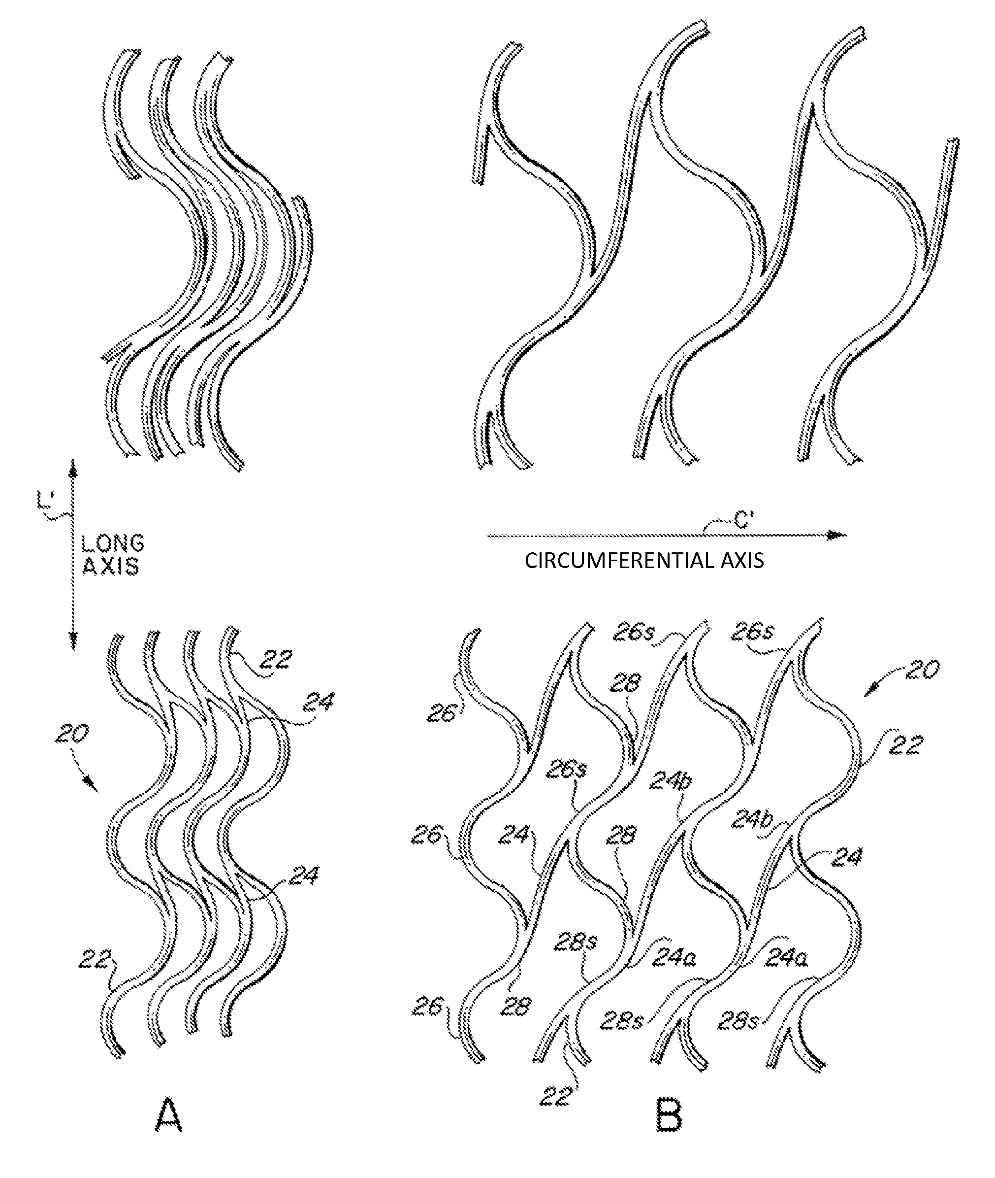 Endoluminal stent, self-supporting endoluminal graft and methods of making same