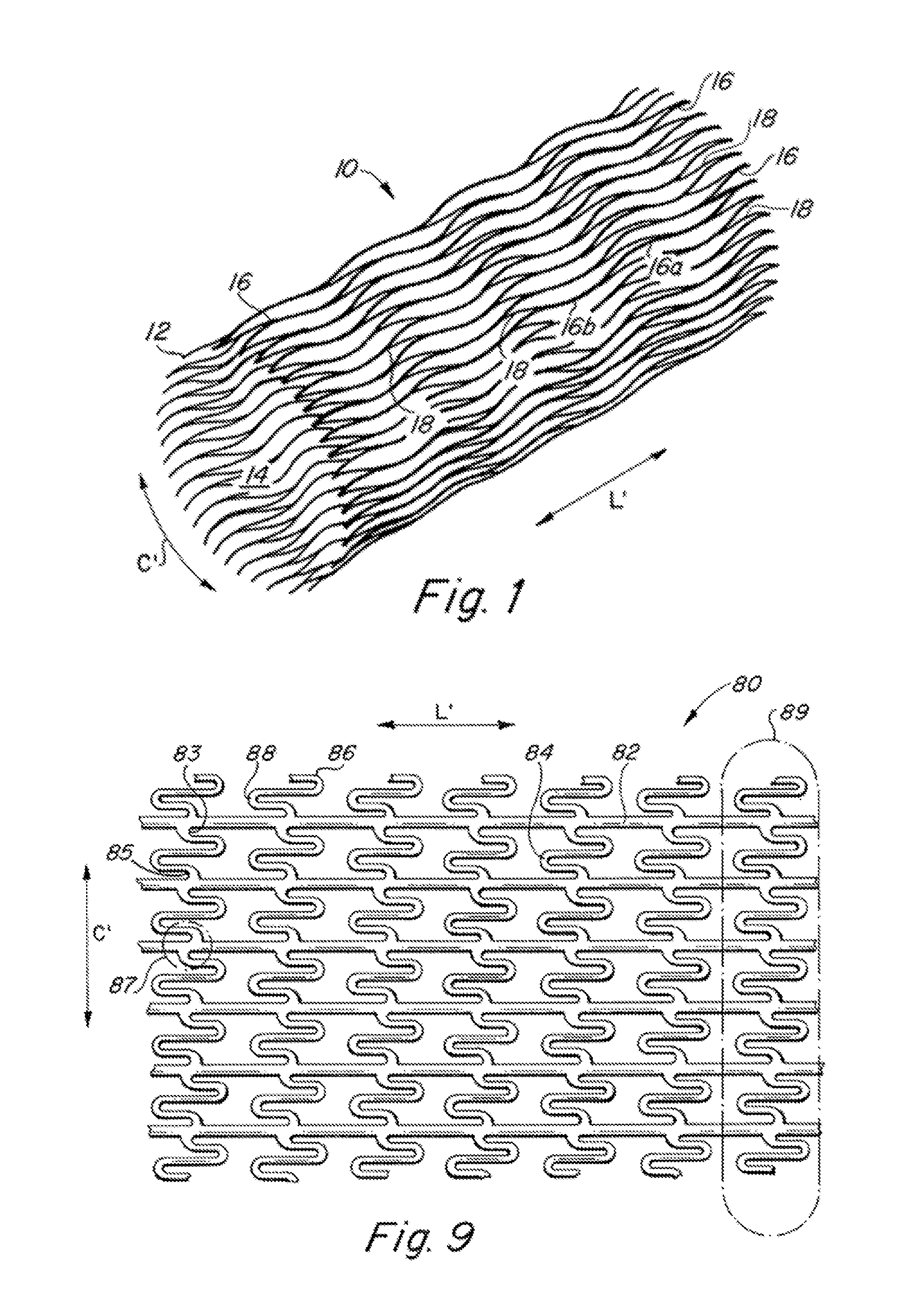 Endoluminal stent, self-supporting endoluminal graft and methods of making same