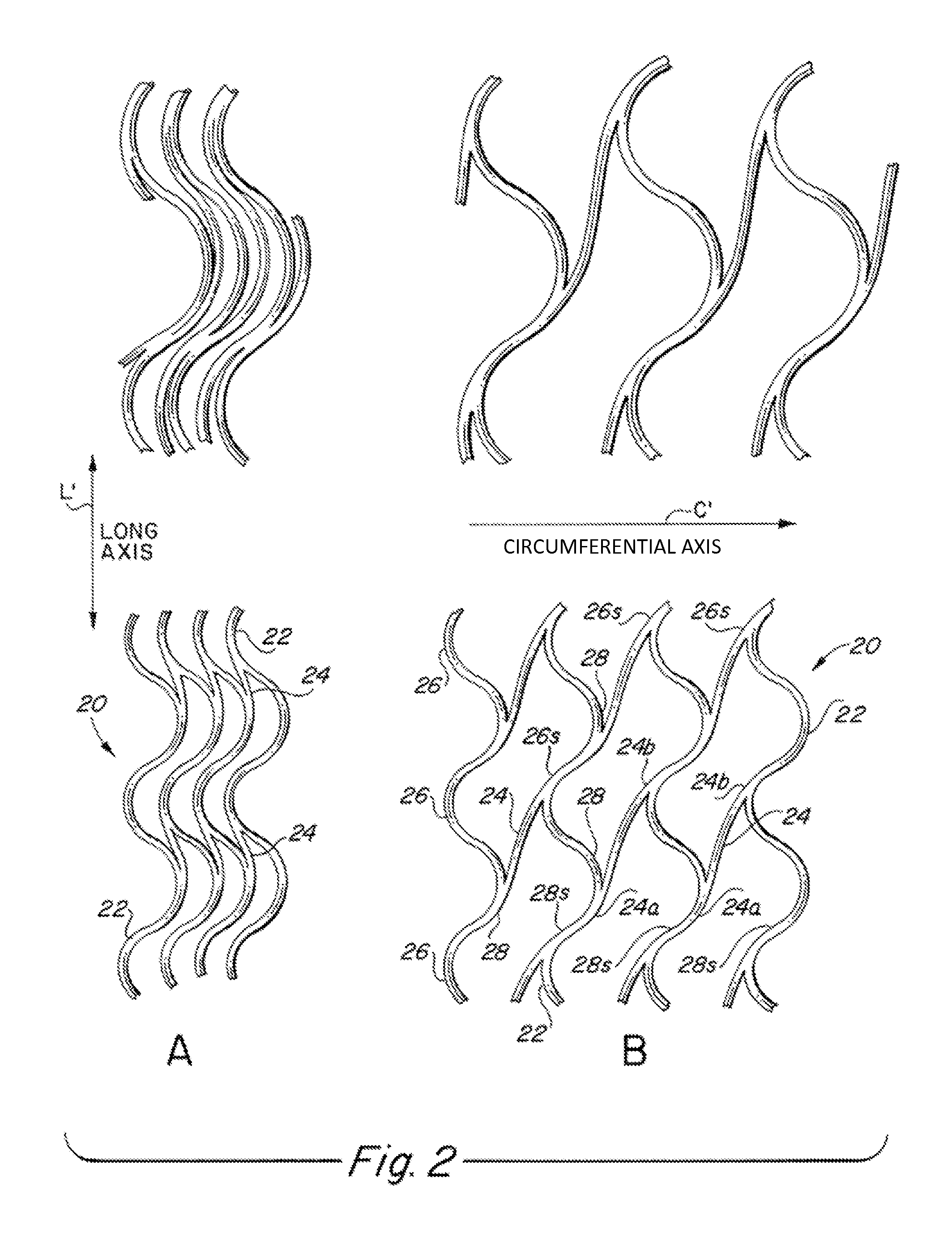 Endoluminal stent, self-supporting endoluminal graft and methods of making same