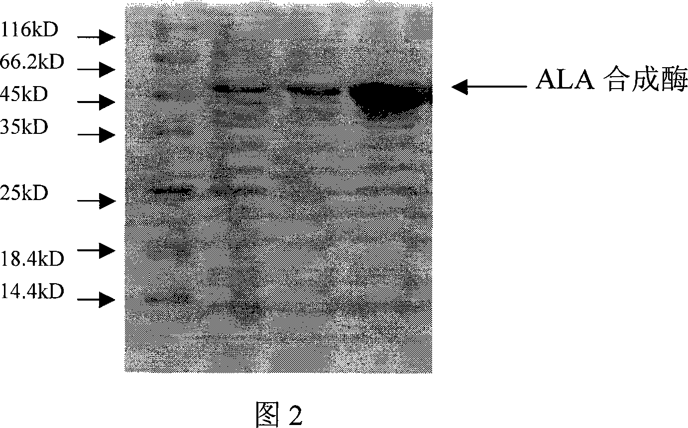 Engineering bacterium producing 5-glycyl ethylformic acid and construction method thereof