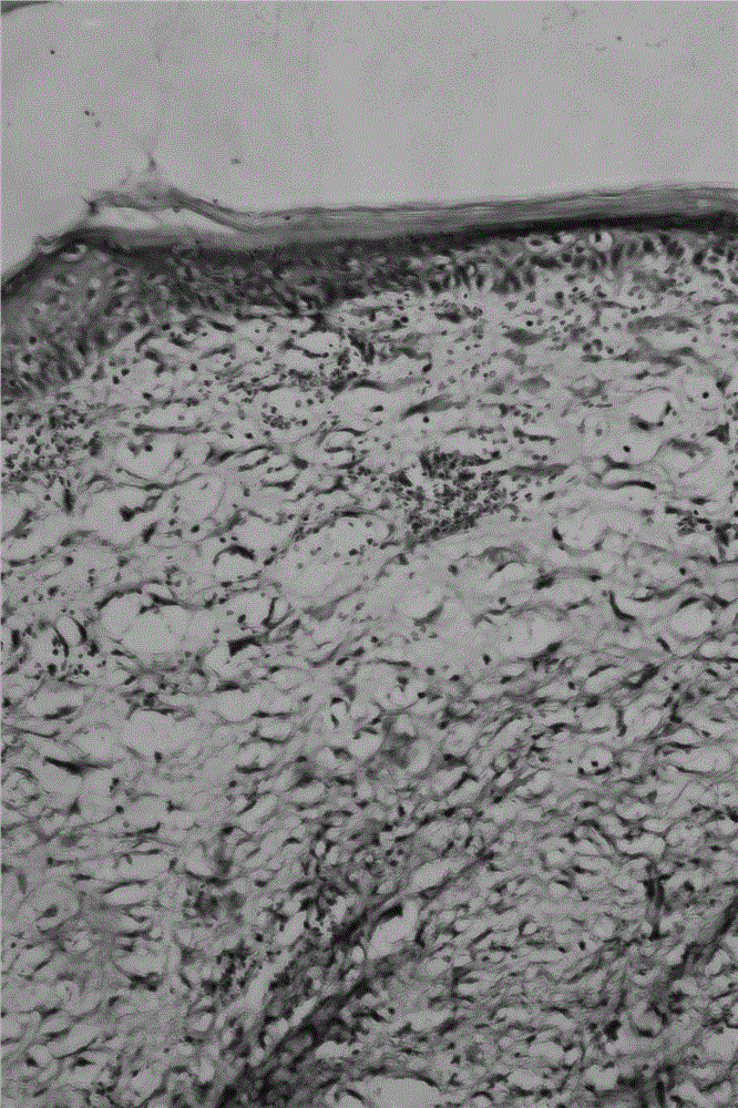 Wound healing agent and radix astragali composite freeze-dried platelet gel kit for preparing wound healing agent