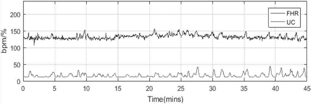 Coupling analysis method for fetal heart rates and uterine contraction signals