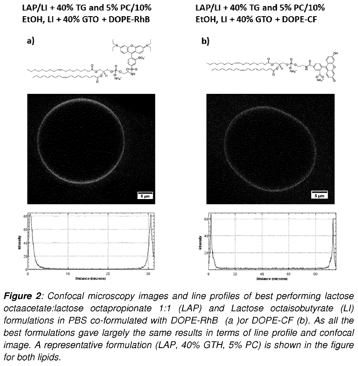 Development of Injectable Fiducial Markers for Image Guided Radiotherapy with Dual MRI and CT Visibility