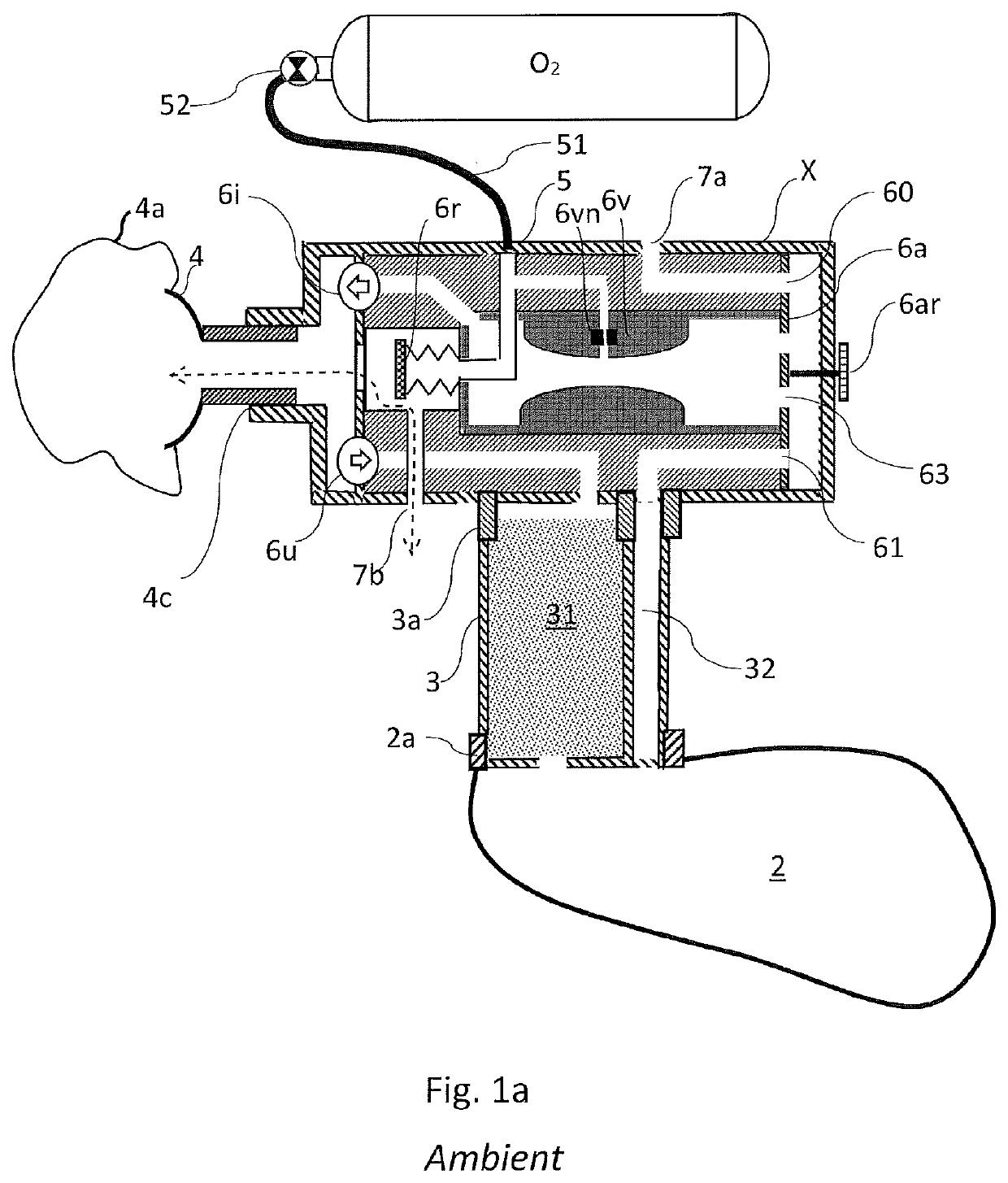 Portable rebreathing system with pressurized oxygen enrichment