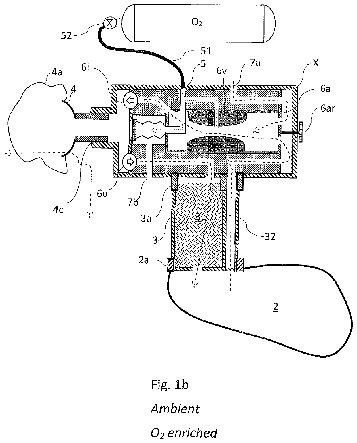 Portable rebreathing system with pressurized oxygen enrichment