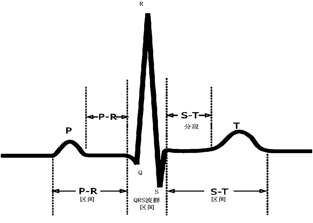 QRS wave group detection method and device