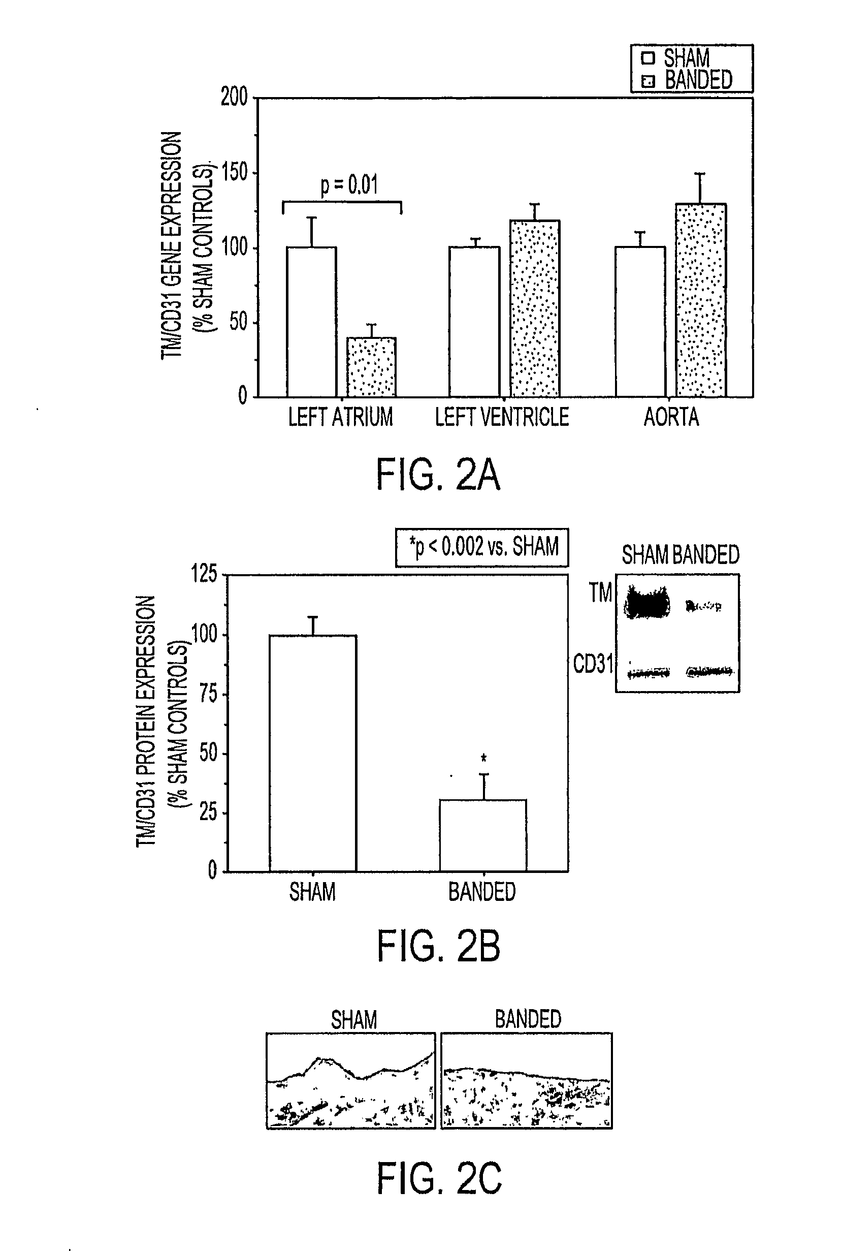 Augmentation of endothelial thromboresistance