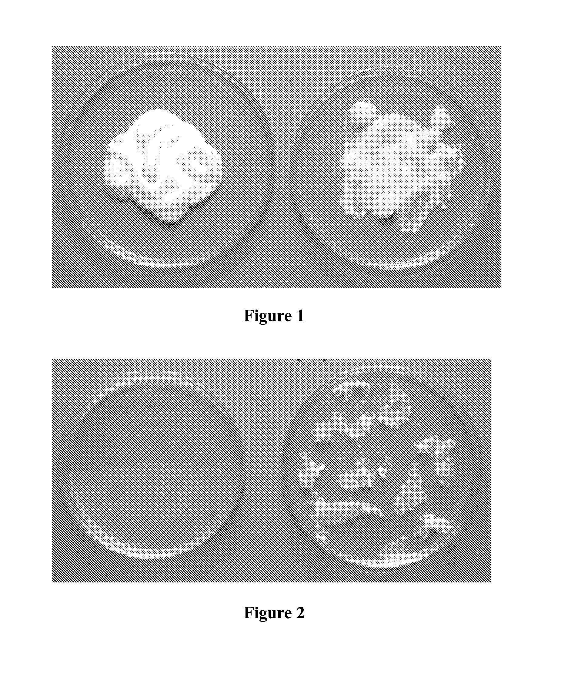 Medicinal cream containing miconazole nitrate, hydrocortisone acetate, and a biopolymer, and a process to make it