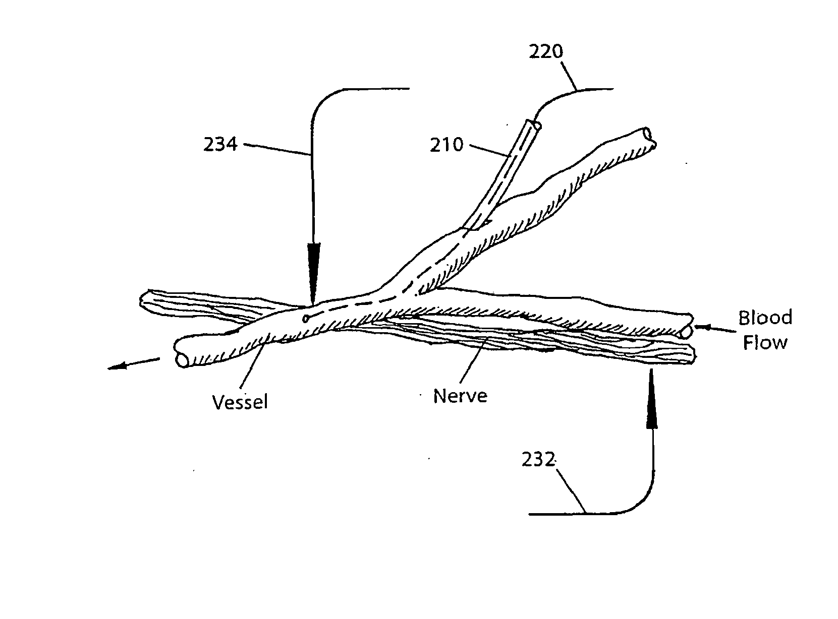 Brain- machine interface systems and methods