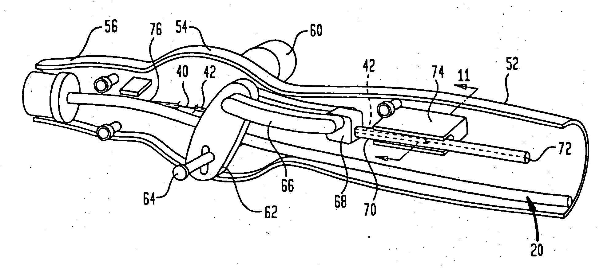 Steerable catheter