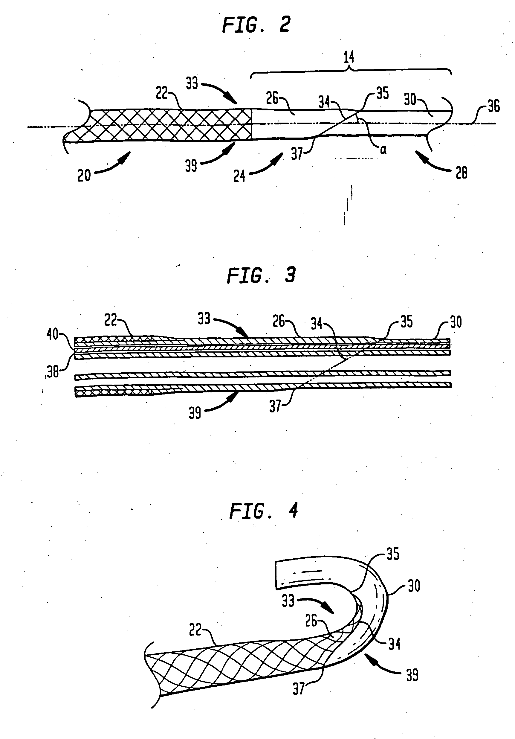 Steerable catheter