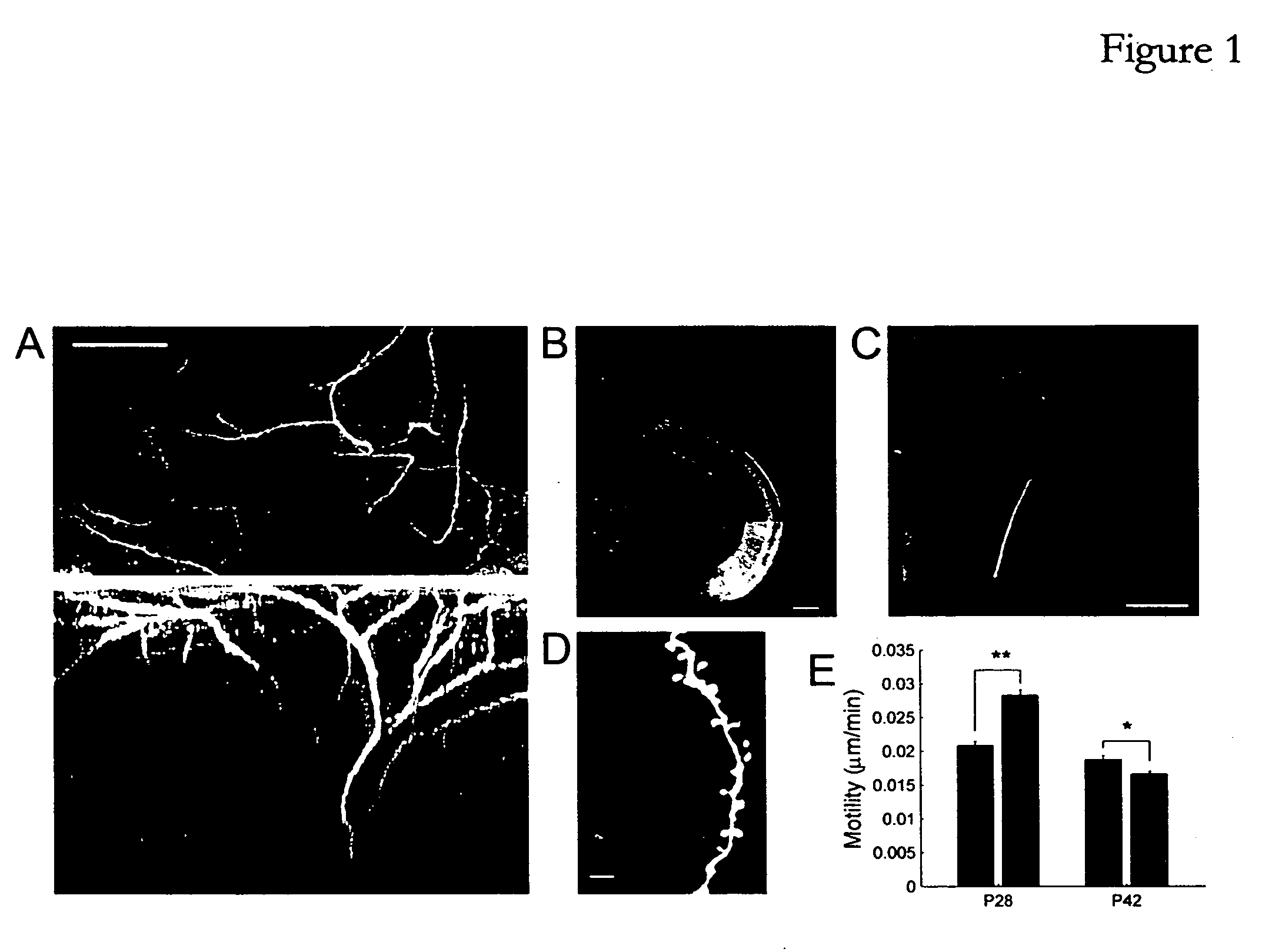 Compositions and methods for enhancing structural and functional nervous system reorganization and recovery