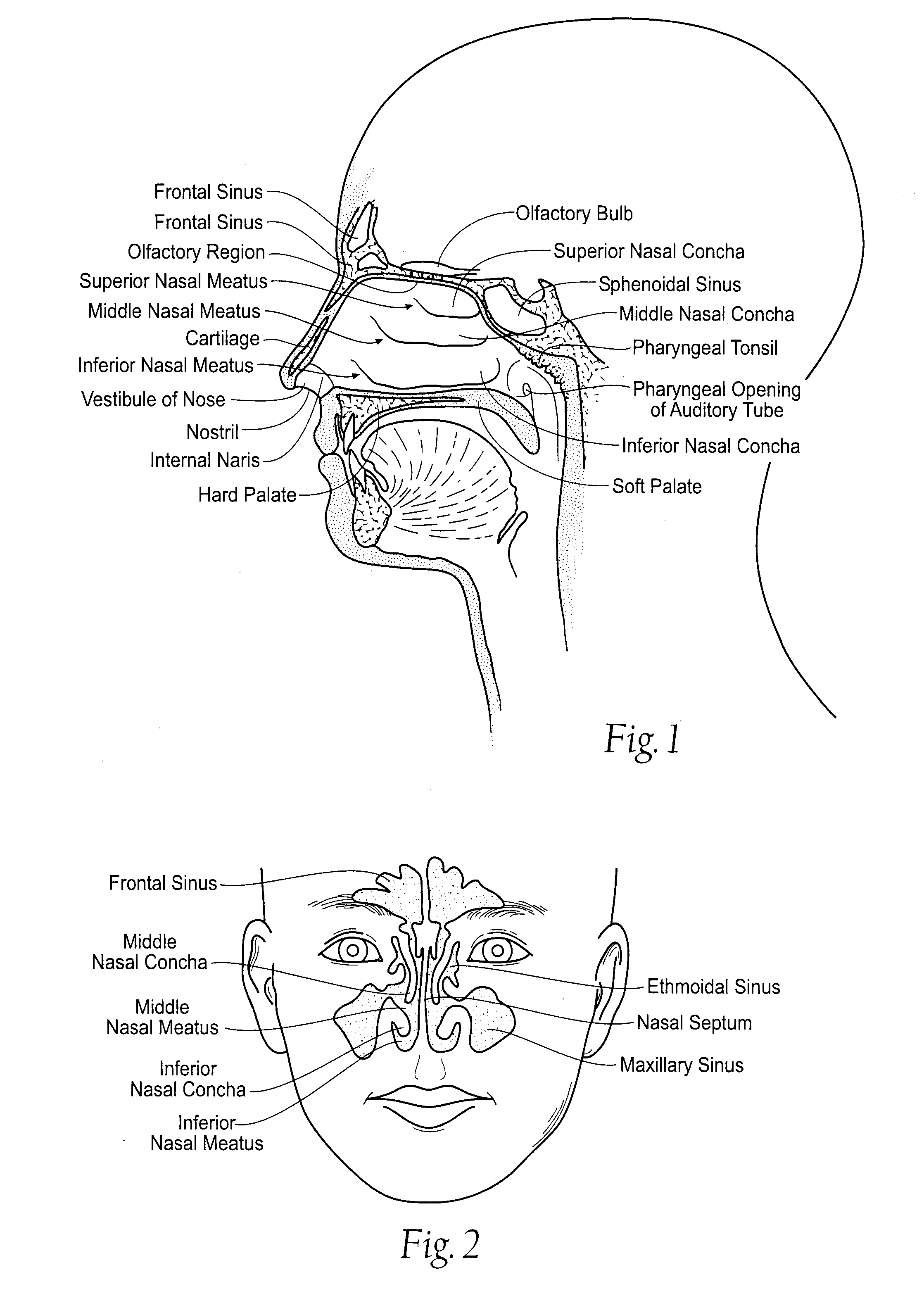 Irrigation and aspiration devices and methods