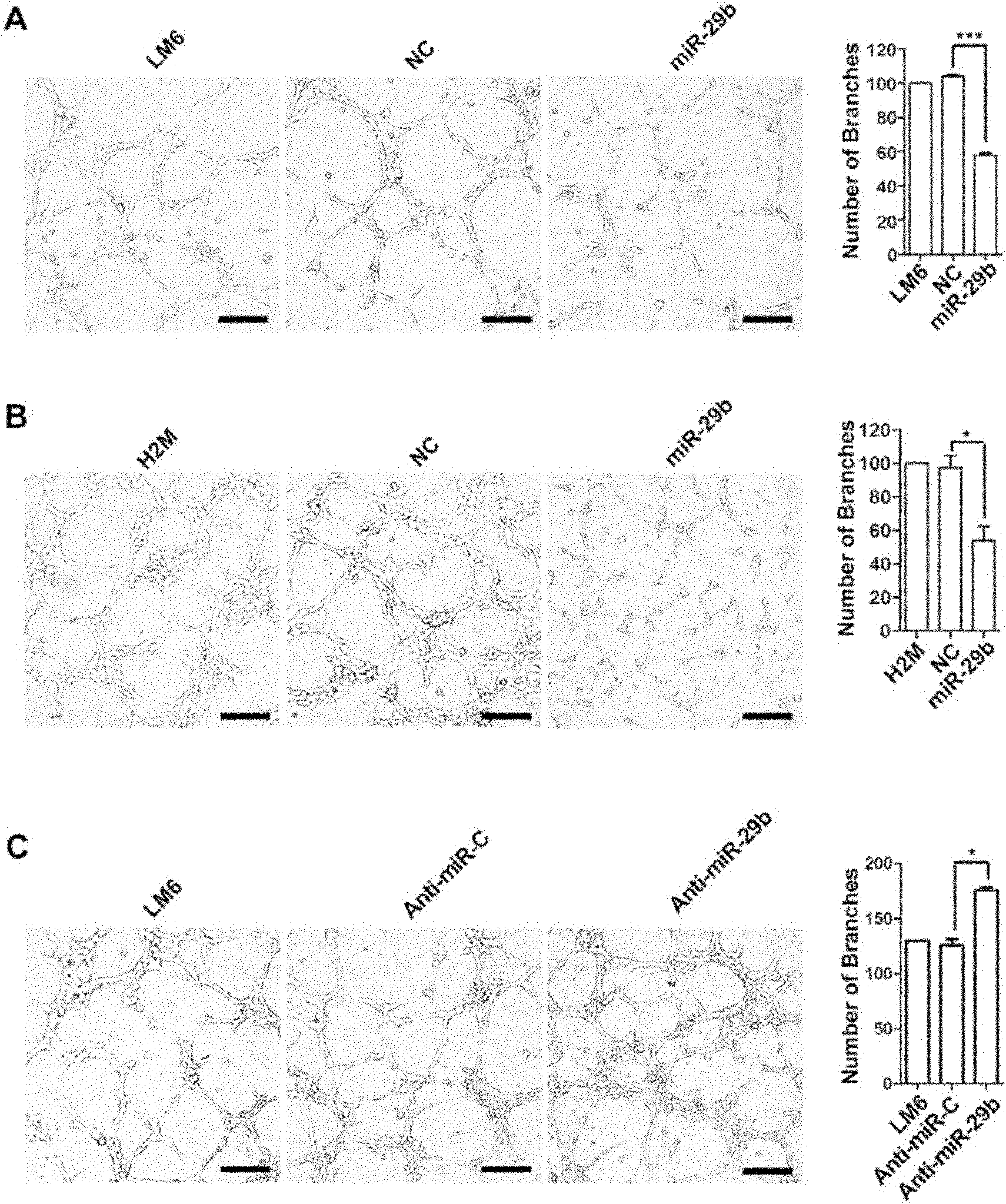 Small molecular non-coding RNA gene hsa-miR-29b and use thereof