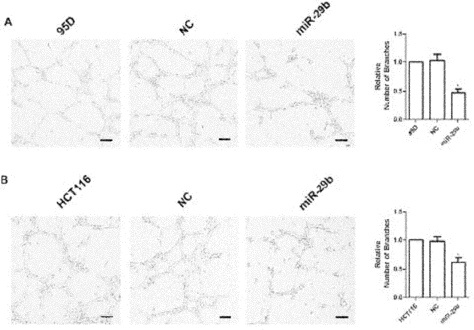 Small molecular non-coding RNA gene hsa-miR-29b and use thereof