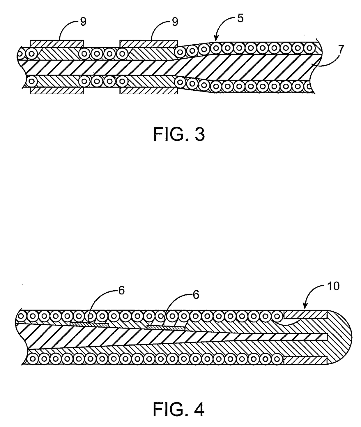 Cardiac motion characterization by strain measurement