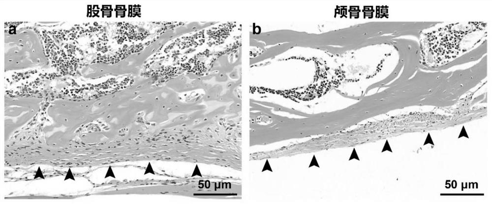 Bionic construction method of periosteum-like tissue