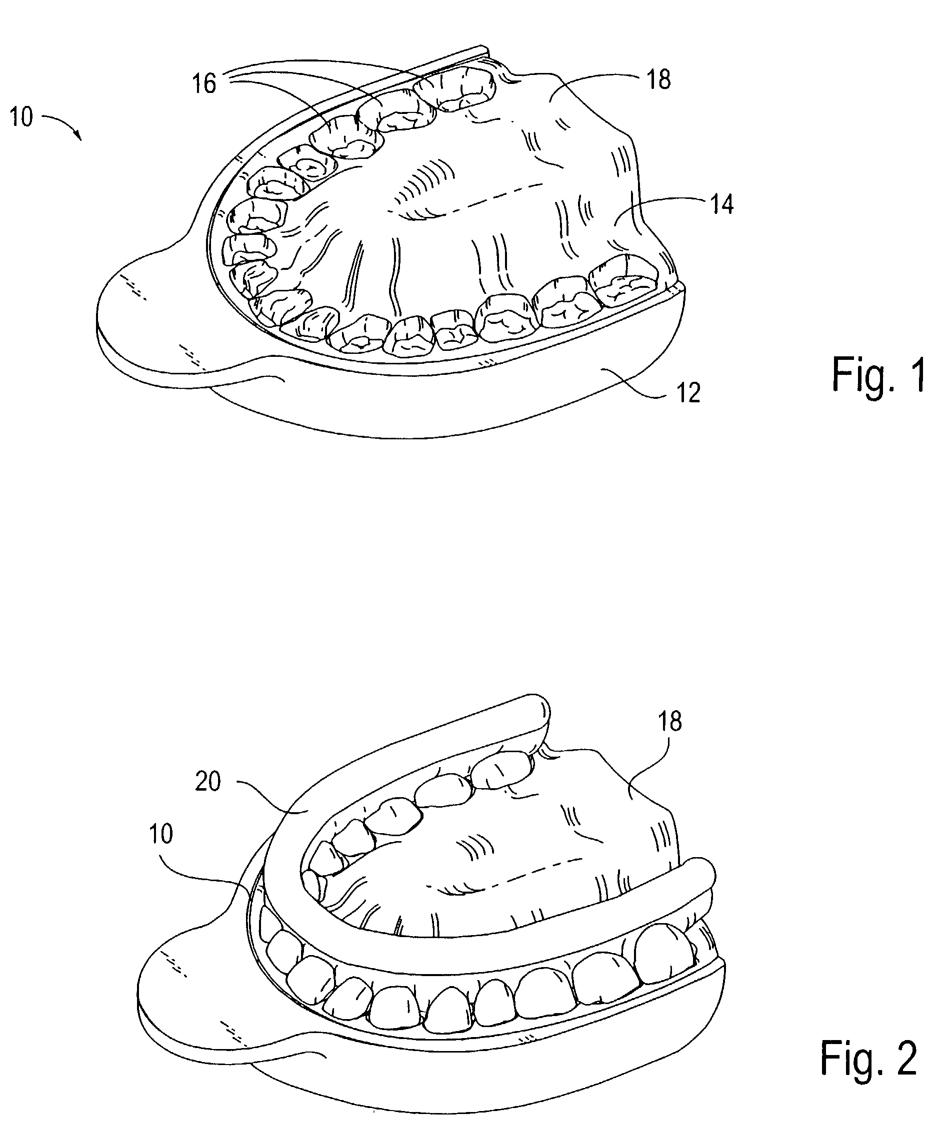 Modified tooth positioning appliances and methods and systems for their manufacture