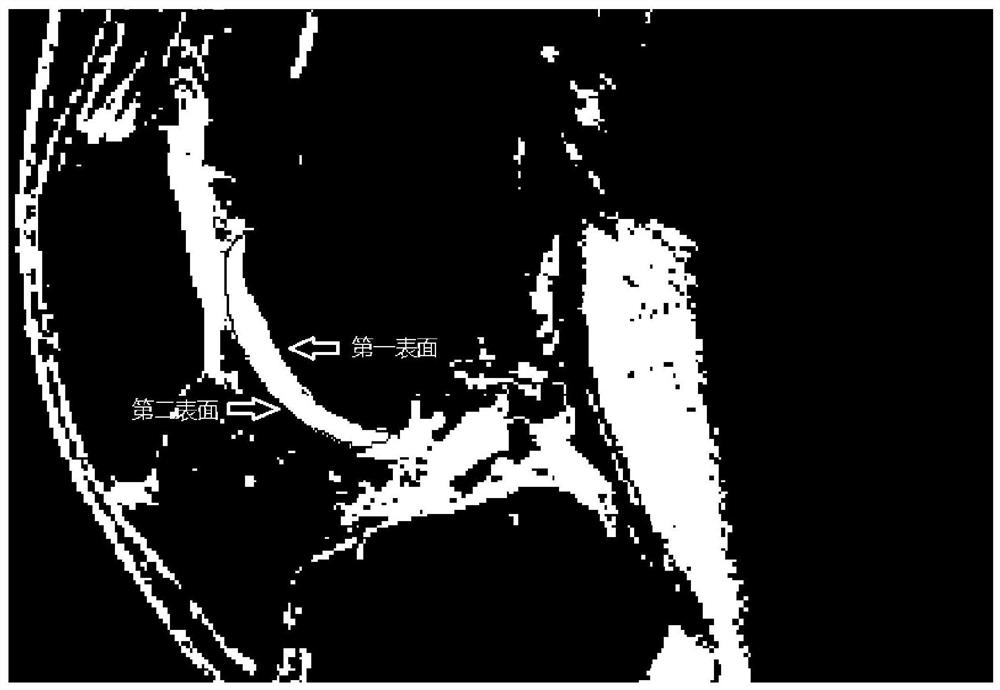 Cartilage thickness measurement method, device, computer equipment and storage medium