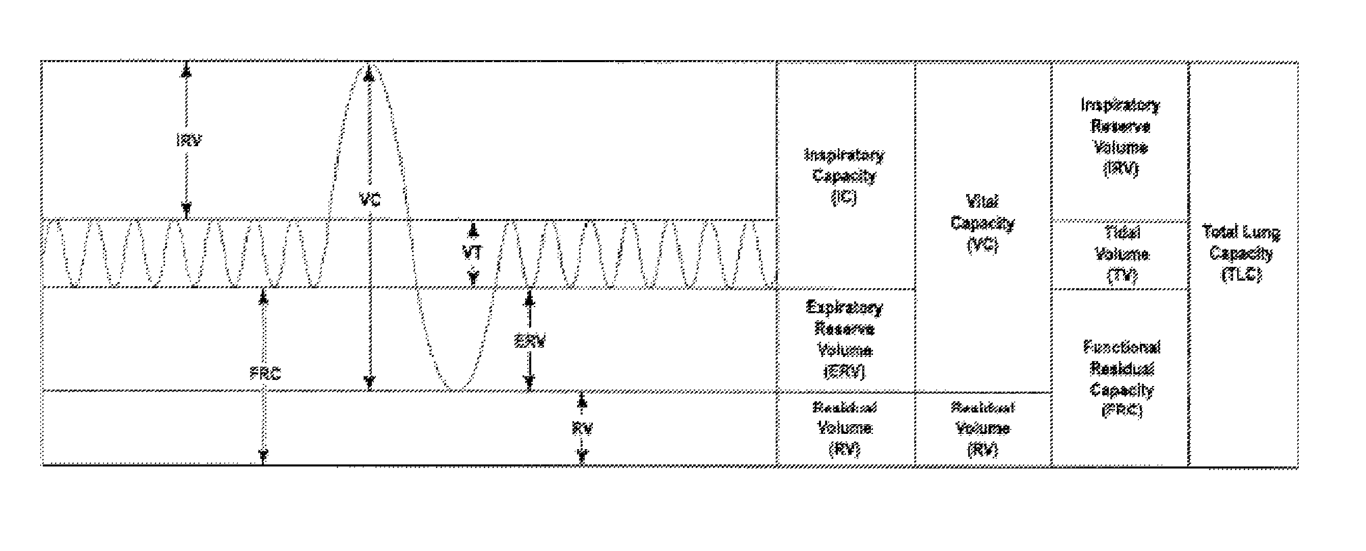 Apparatus and methods for assisting breathing