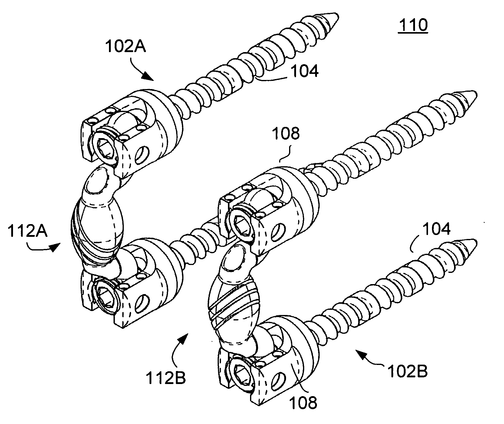 Vertebral facet stabilizer