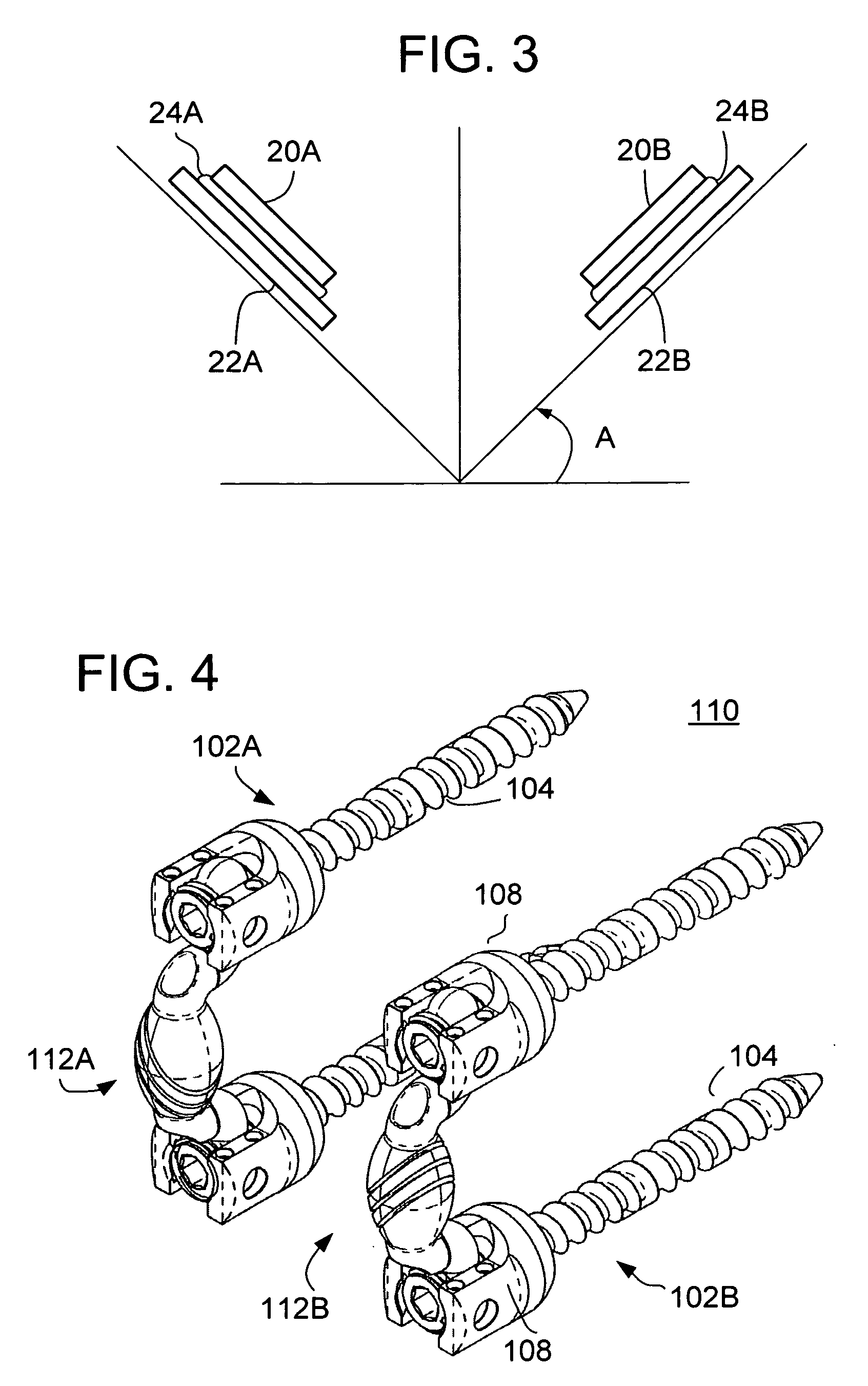 Vertebral facet stabilizer