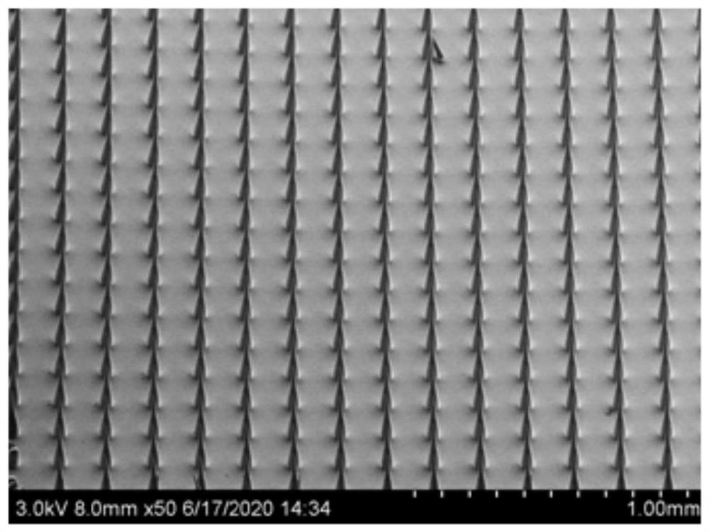 Soluble breast enlarging microneedle and preparation method thereof