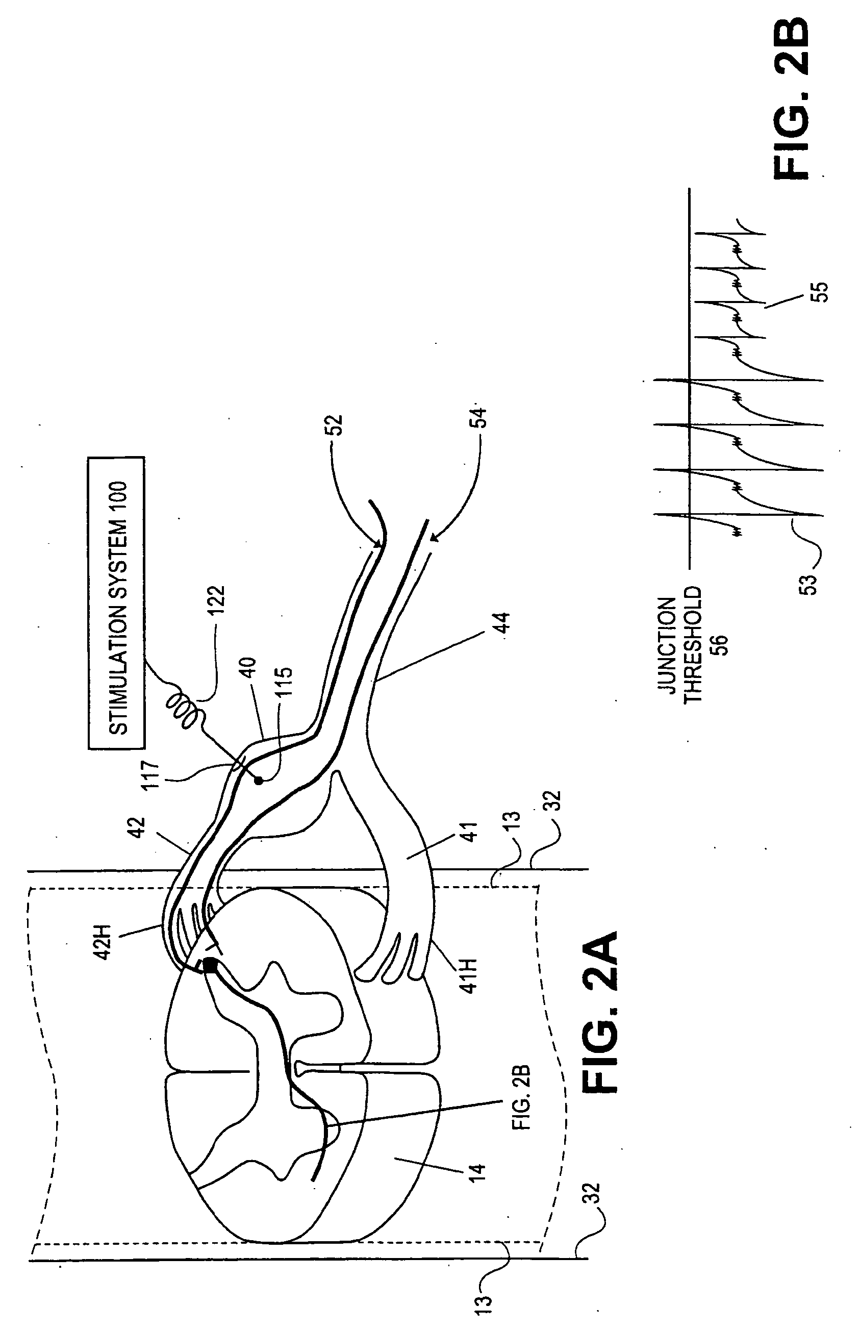 Methods of neurostimulating targeted neural tissue