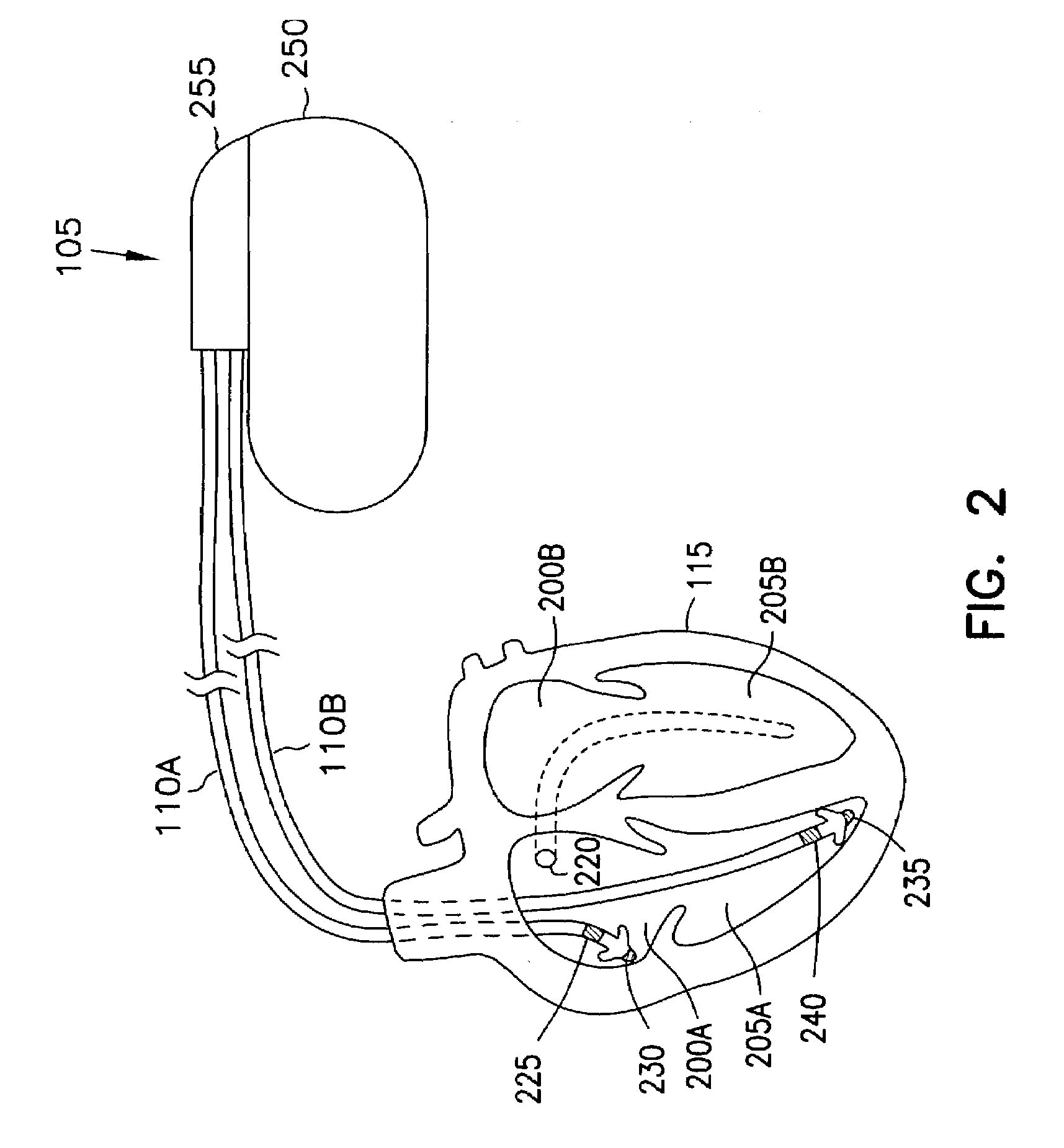 Event marker alignment by inclusion of event marker transmission latency in the real-time data stream