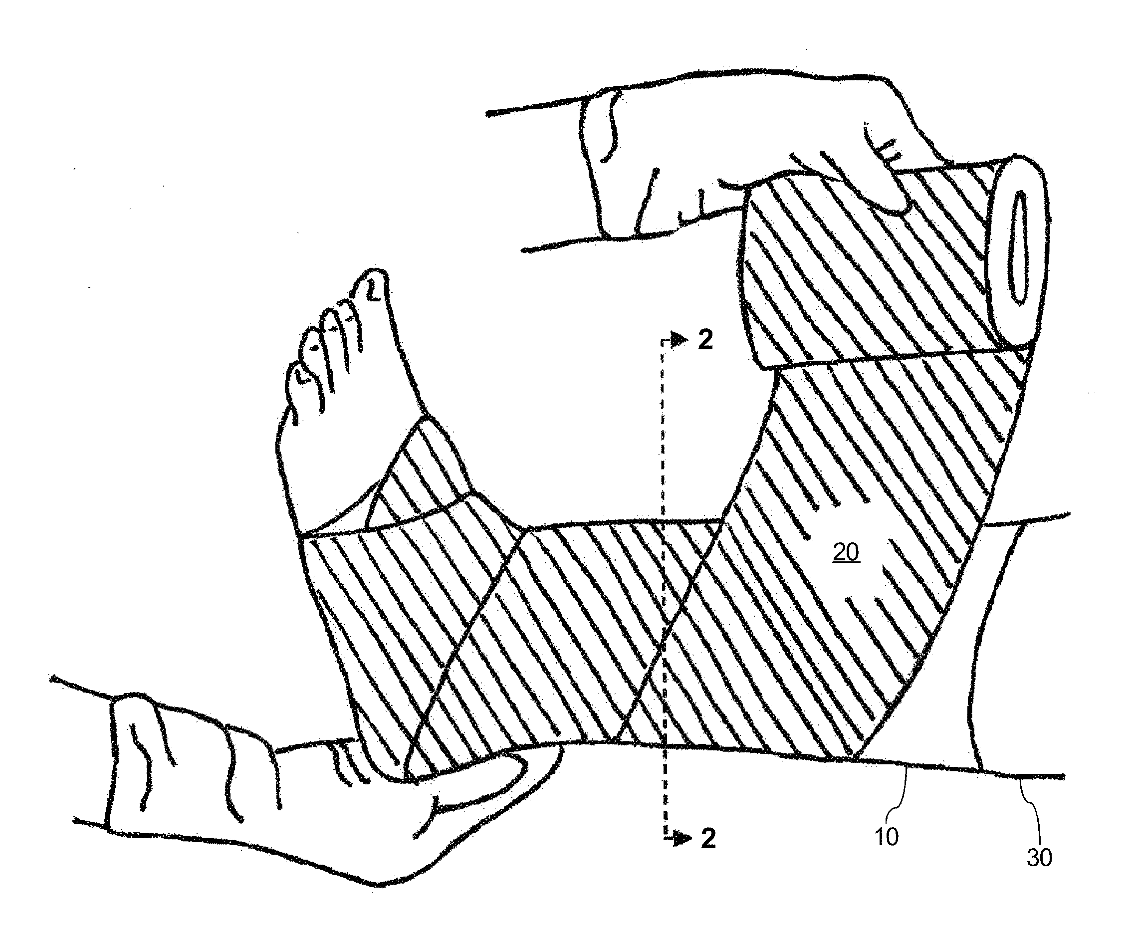 System and method for treating leg ulcers