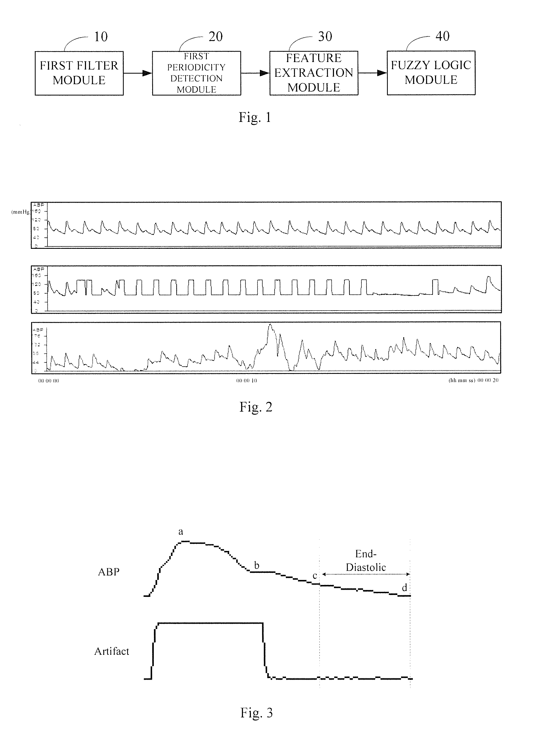 System for quality assessment of physiological signals and method thereof