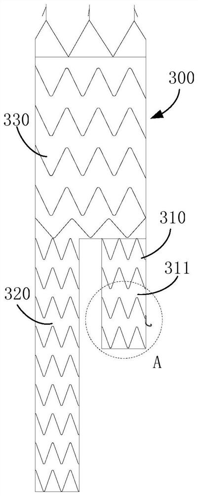 implant system