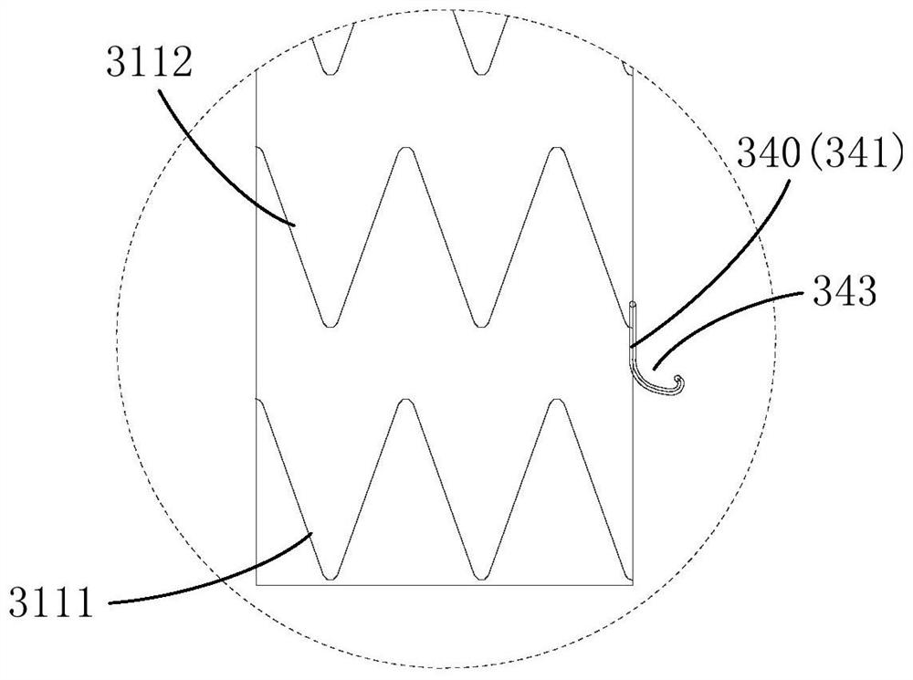 implant system