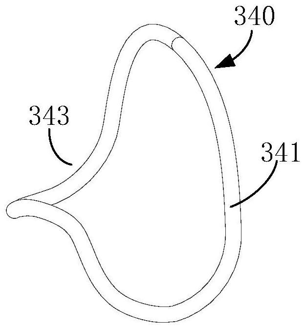 implant system