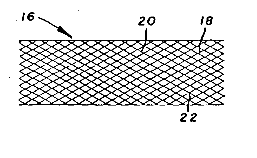 Clad composite stent