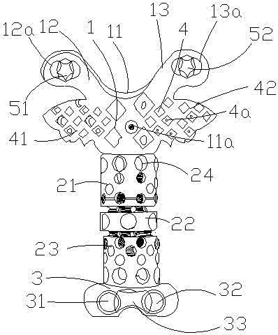 Second cervical vertebra displacer with merging structure