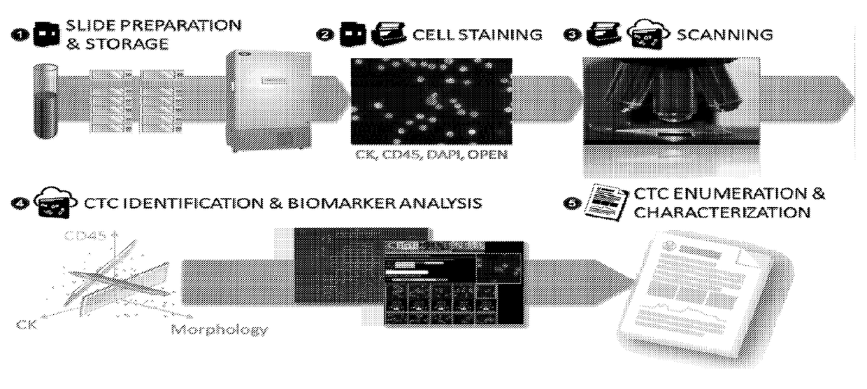 Single cell genomic profiling of circulating tumor cells (CTCS) in metastatic disease to characterize disease heterogeneity