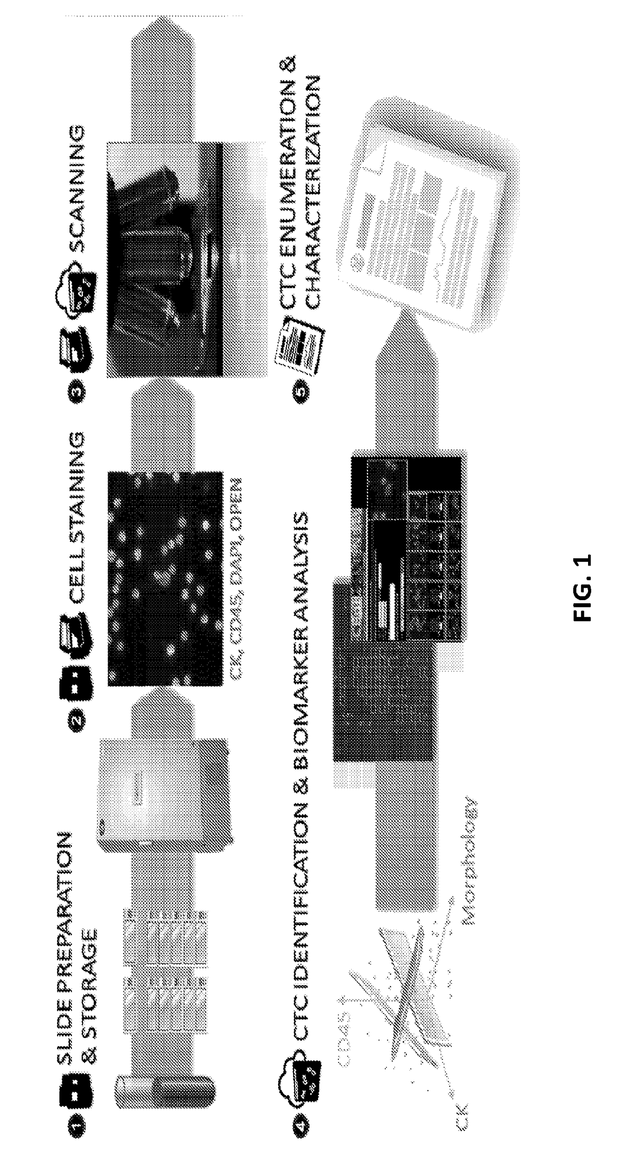 Single cell genomic profiling of circulating tumor cells (CTCS) in metastatic disease to characterize disease heterogeneity