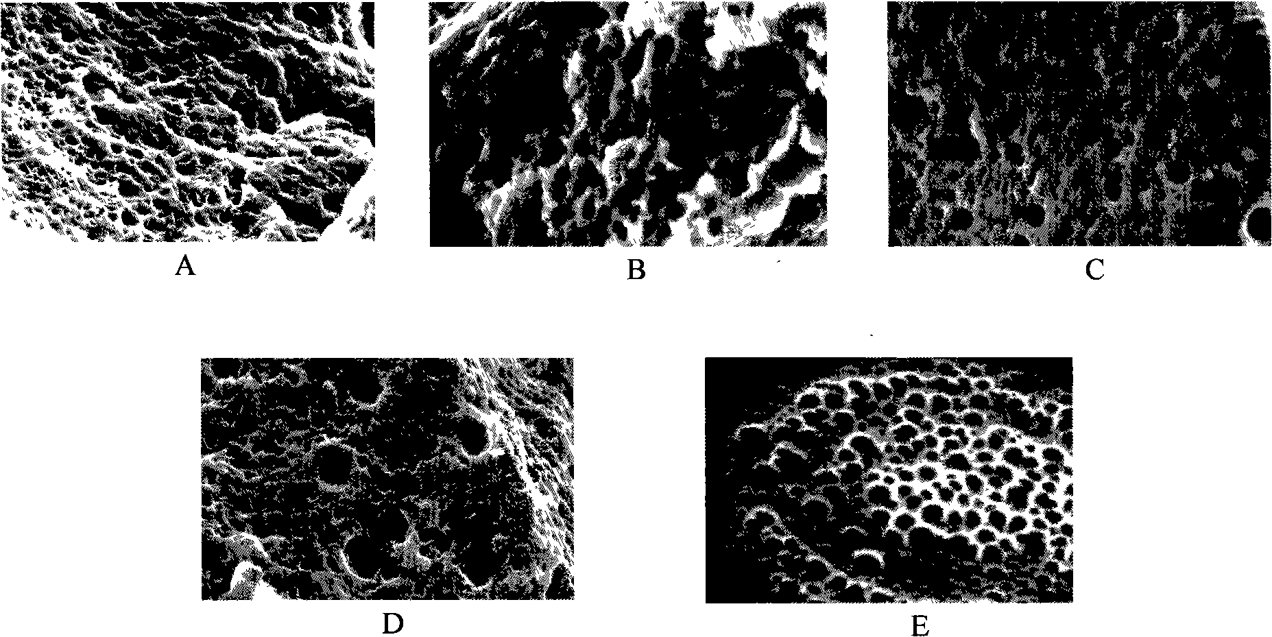 Bioactive aquagel-conductive polymer nanometer composite material and synthetic material thereof