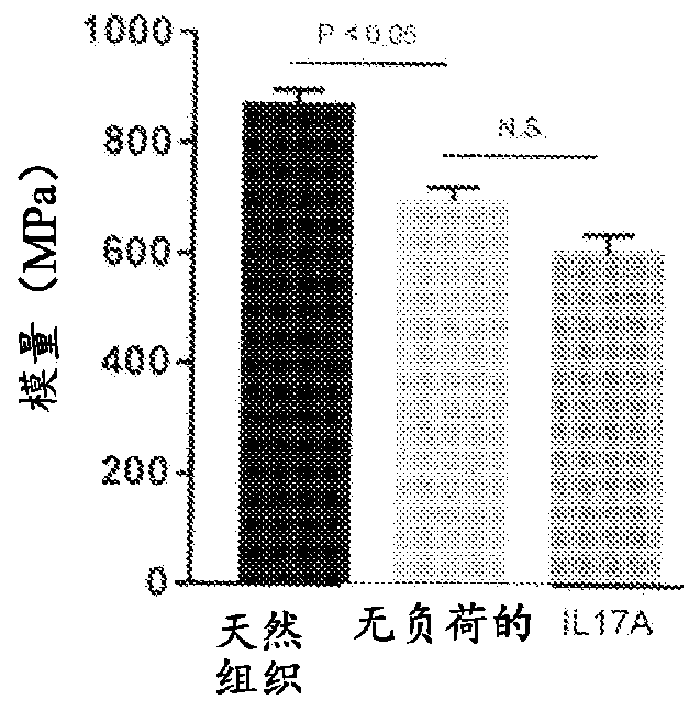 Method of treating tendinopathy by using interleukin-17 (il-17) antagonist