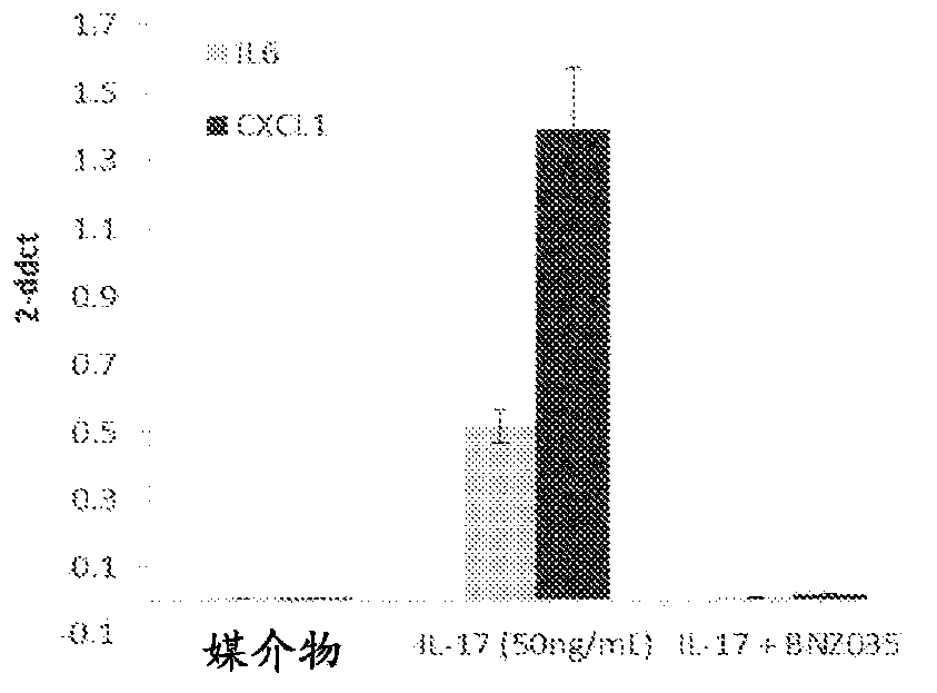 Method of treating tendinopathy by using interleukin-17 (il-17) antagonist