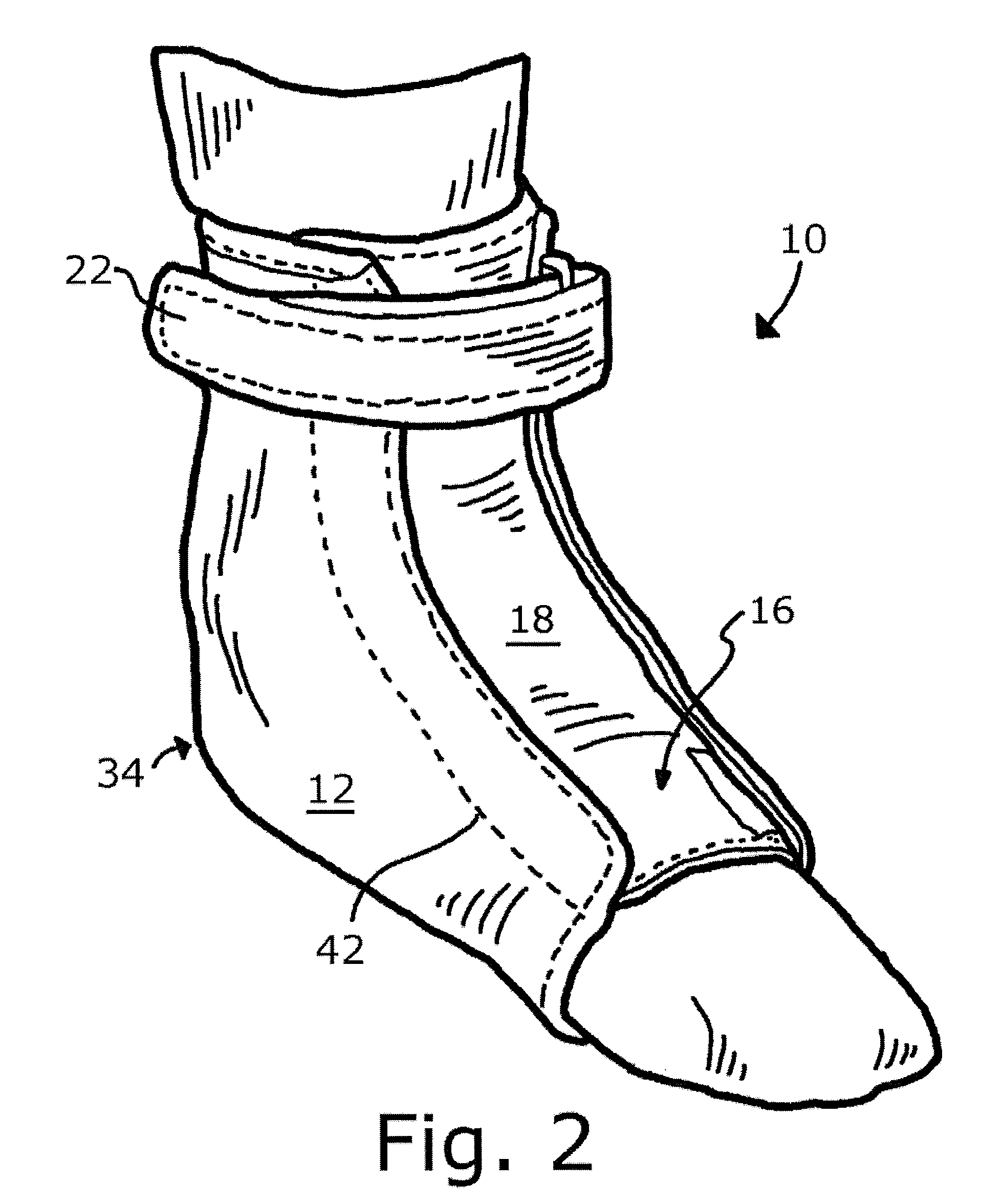 Molded ankle-foot orthoses and methods of construction