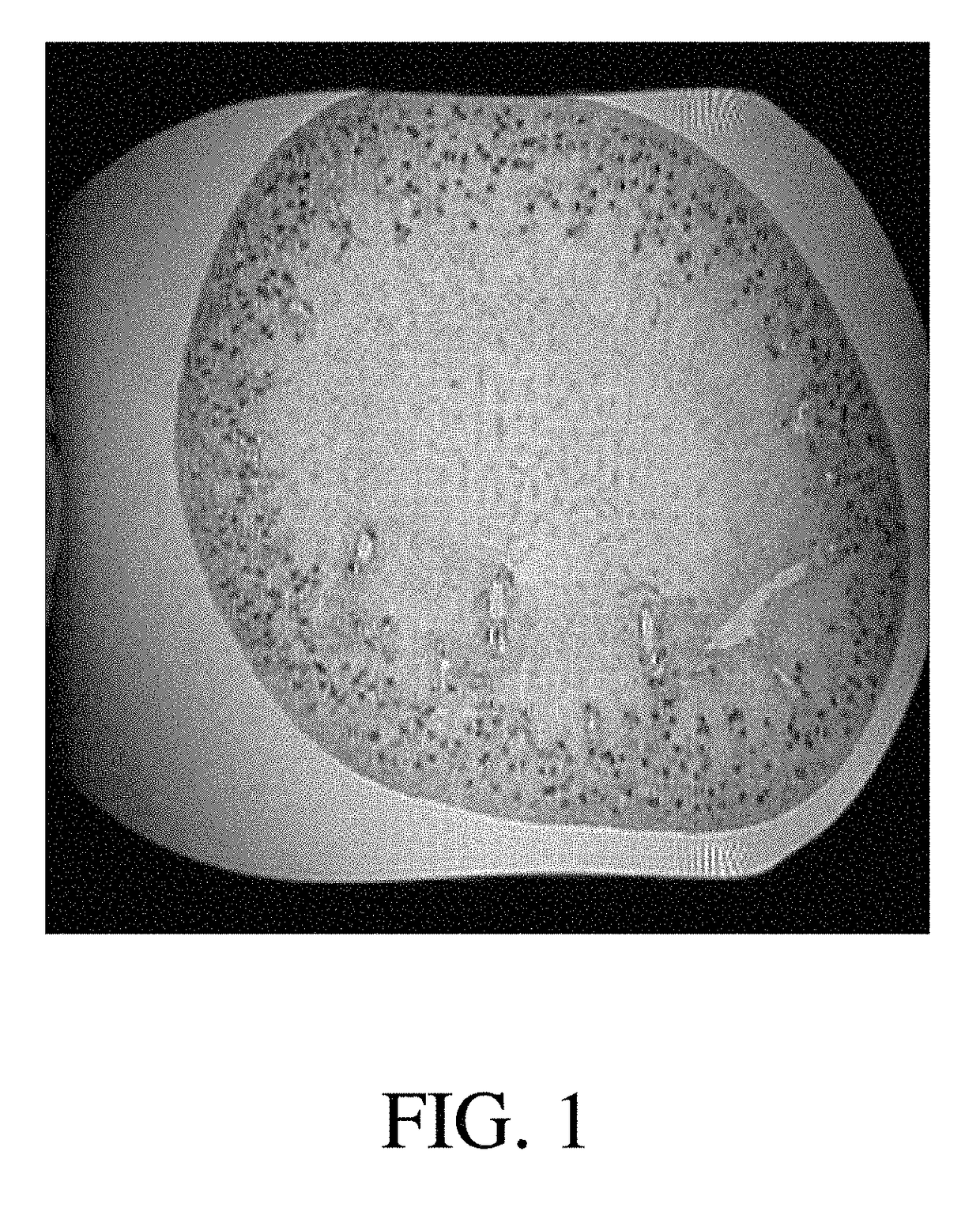 Measuring glomerular number from kidney MRI images