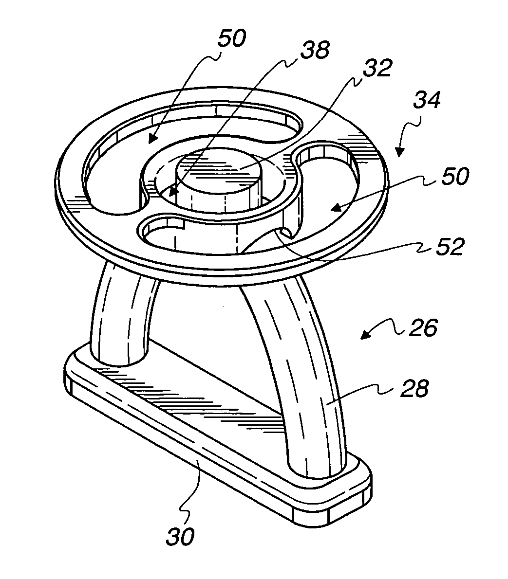 Myringopexy type titanium prosthesis