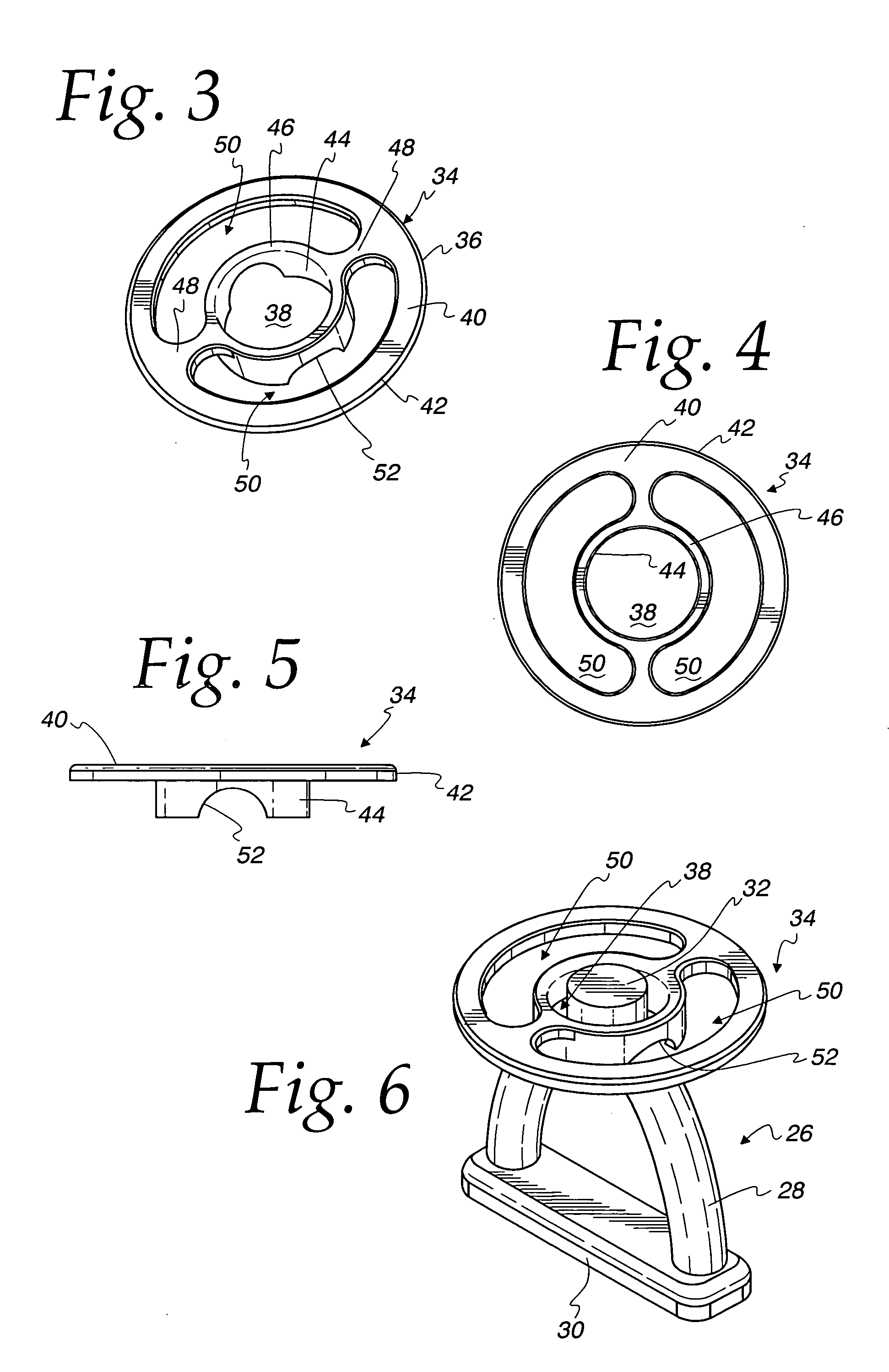 Myringopexy type titanium prosthesis